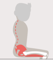 Anterior Pelvic Tilt (- sagittal pelvic angle)