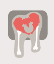 Pelvic Rotation (transverse pelvic angle)