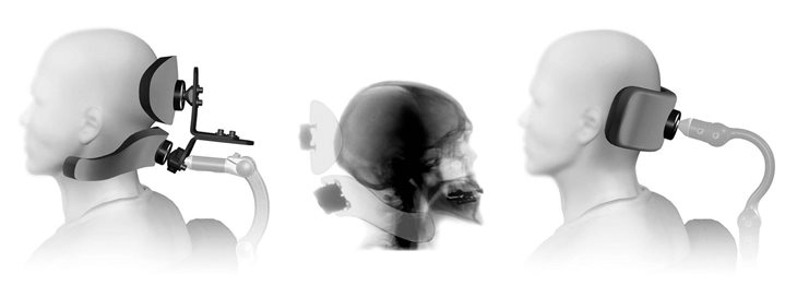 Guide for Finding the Best Head Position for Your Client