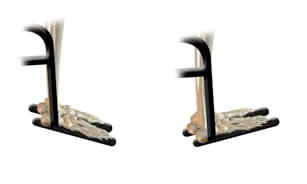 Anatomical illustration of angle-adjustable footplates