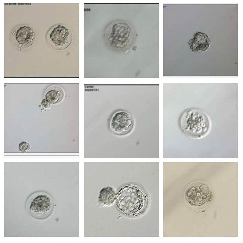 Jessica and Jason's 11 embryos they transferred over two years