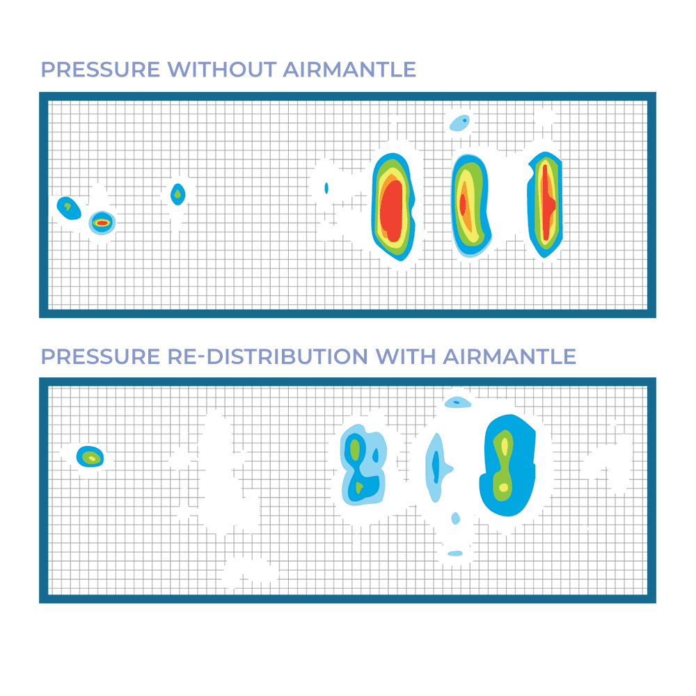 Skin protection and comfort: Airmantle